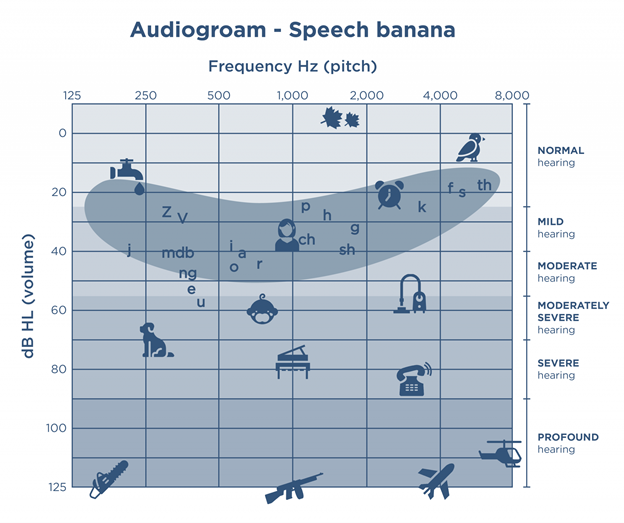 Speech banana with icons audiogram with icons depicting sound sources and the banana shaped area where speech sounds are located