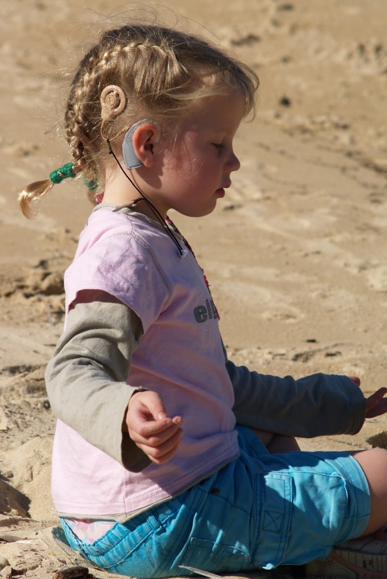 Child wearing a coclear implant Child wearing a cochlear implant