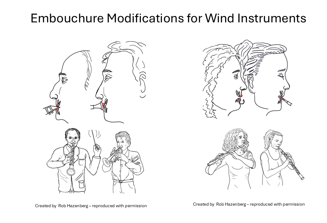 Embouchure-Modifications-for-Wind-Instruments