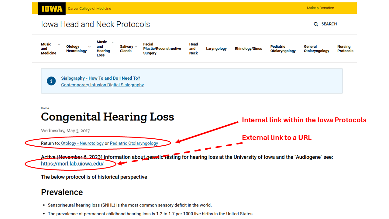 internal v external links