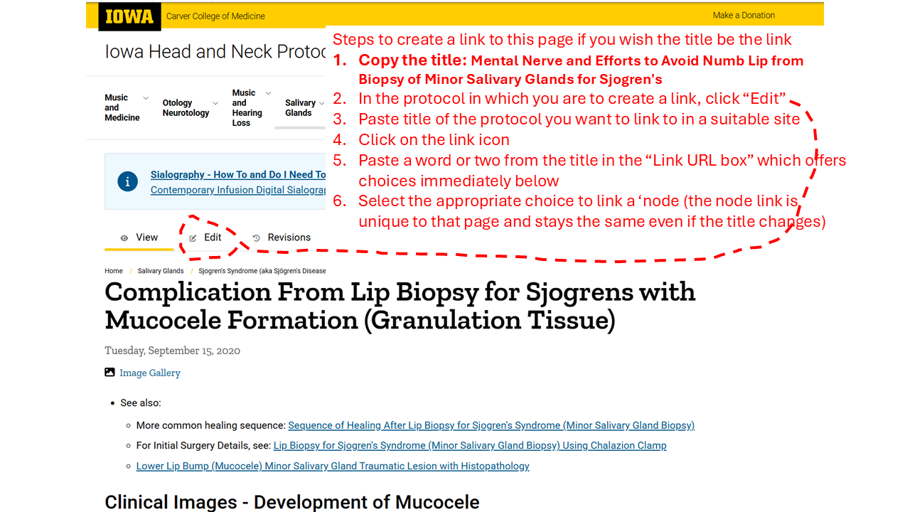 first steps in creating links