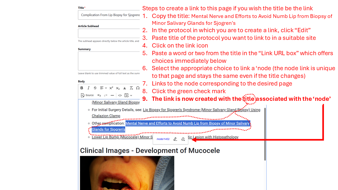 link with title associated with node