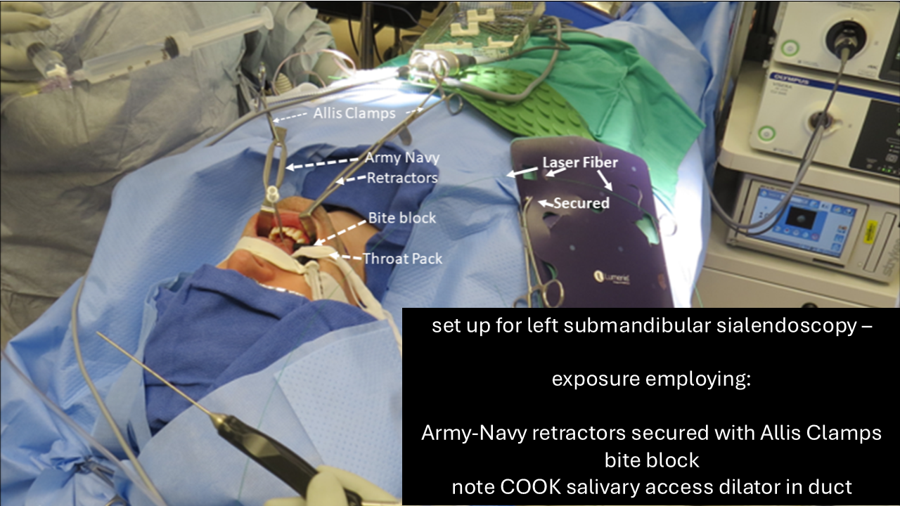 smg-setup-sialendo-11-2025