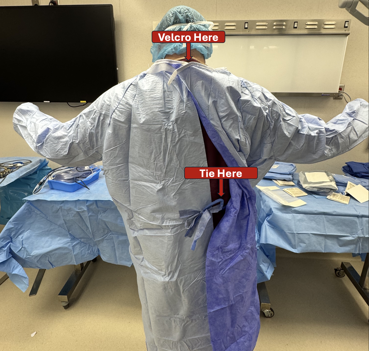Image of a gown tied