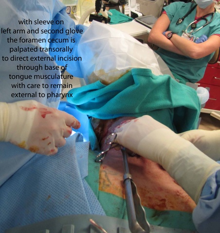0018%20foramen%20cecum%20palp.jpg