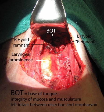 0023%20anatomy%20after%20resection.jpg