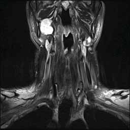 003mri.jpg