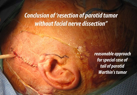 005%20c%20warthins%20resection.jpg
