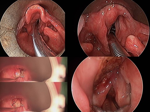 005%20surgery.jpg