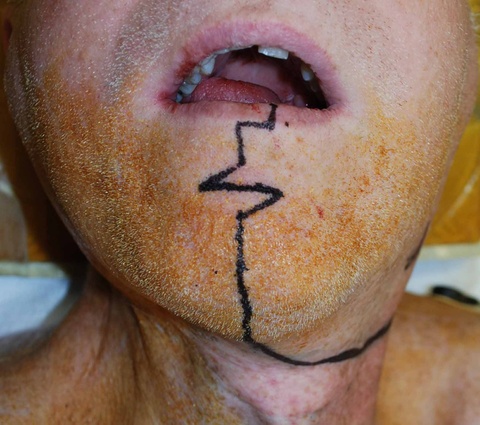 01%20design%20incision.jpg 01%20design%20incision.jpg