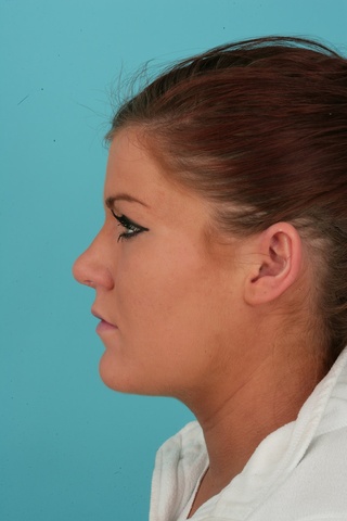 Lateral Postop