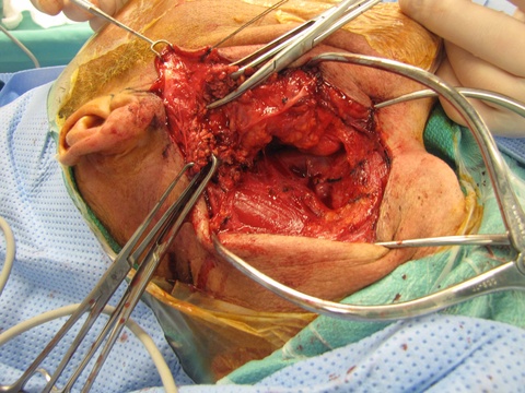 012surg.jpg