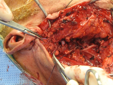 014surg.jpg