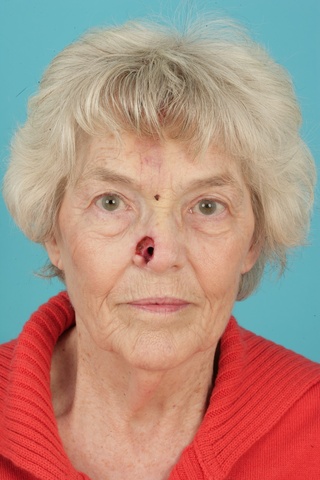 Preop Anterior view 