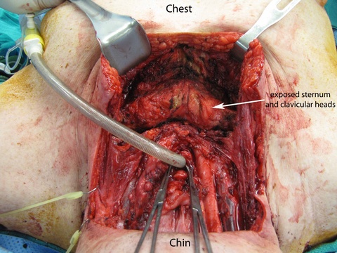 025%20medtrach.jpg