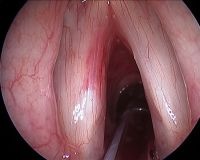 Intraoperative photos September 2009 