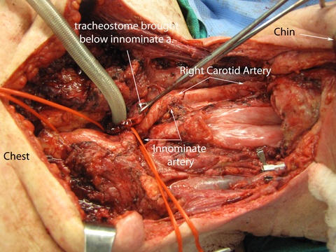 031%20medtrach.jpg