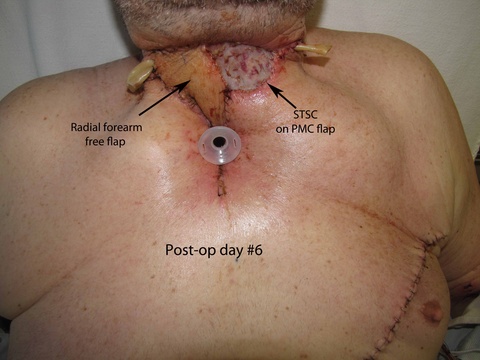 040%20medtrach.jpg