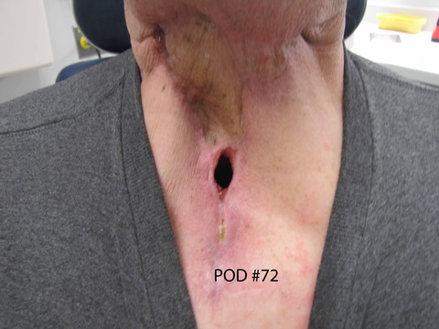 060%20med%20trac%20pod%2072.jpg