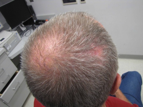 063 fu 3 months.jpg