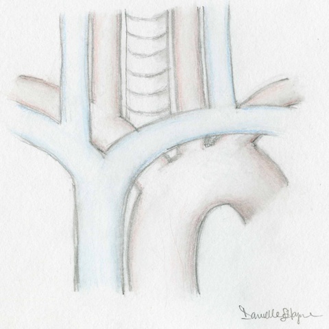 090%20Aorta-Esoph%20low%20res.jpg