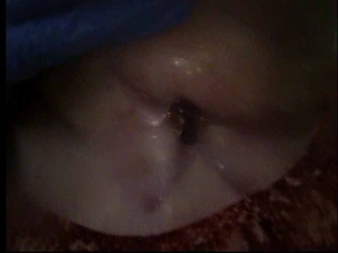 092%20fu%20epi%20trach%20090811.jpg