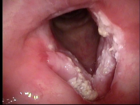 2012 May