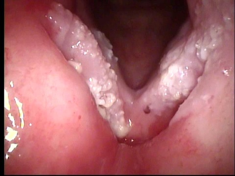 2012 March
