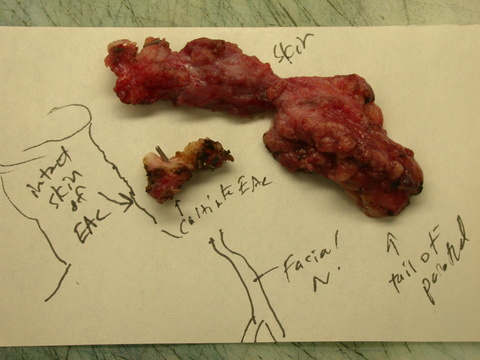 Diagram of Surgical Anatomy