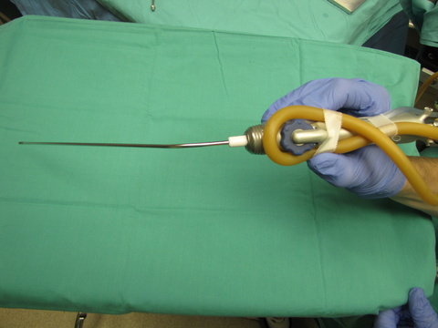Microdebrider with 'suction modulator'