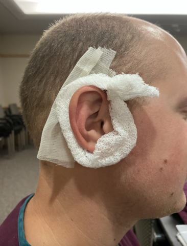 Mastoid Dressing Apply