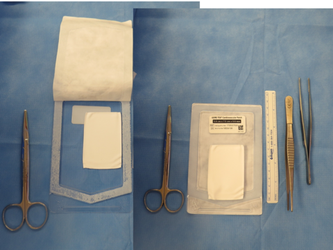 Previously available GORE-TEX thyroplasty implant no longer available - requires fashioning for CV patch