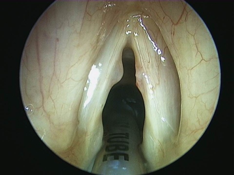 Slide1_23.JPG