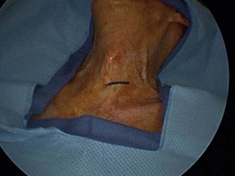 Slide1_39.JPG