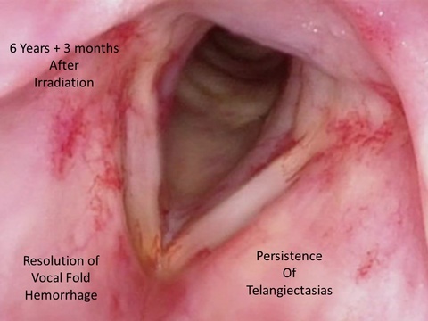 Slide1_48.JPG