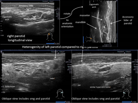 Longitudinal view and oblique views