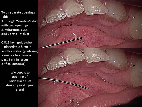 Slide2_0.JPG