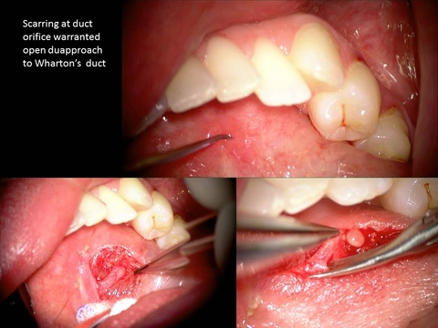 Slide2_33.JPG