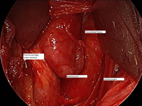 Slide2_40.JPG