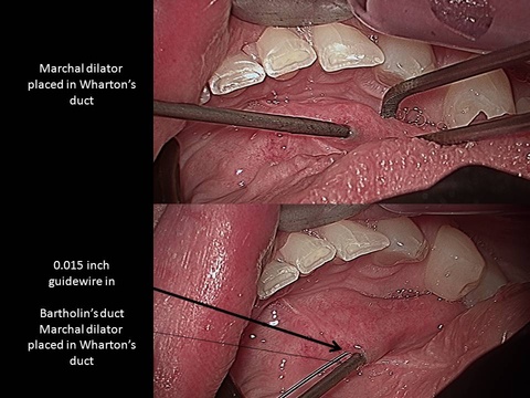 Slide3_0.JPG