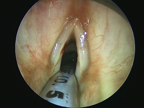 Slide3_22.JPG