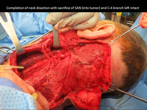 Slide3_23.JPG