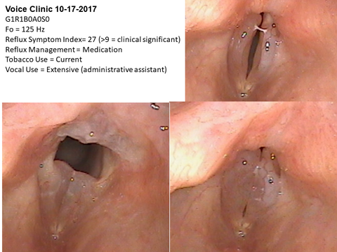 Dysphonia 2017
