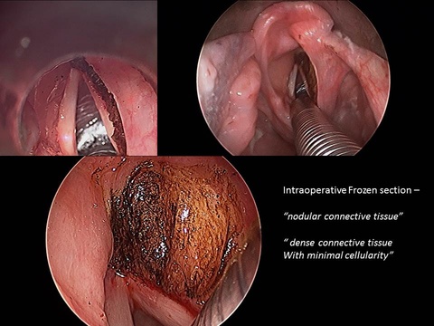 Slide4.JPG
