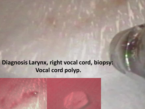 Slide5_32.PNG
