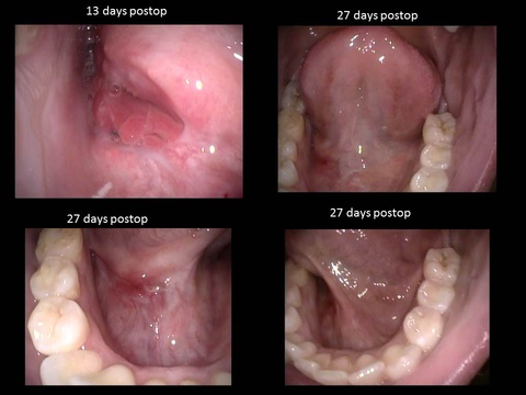 Slide6_13.JPG