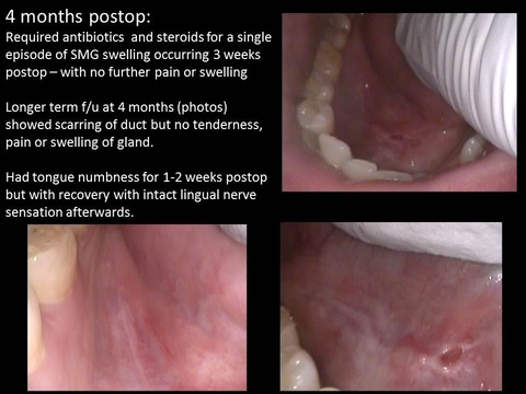 Slide7_8.JPG