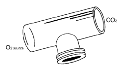 tracheostomy10_0.gif