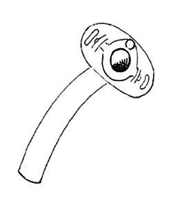 tracheostomy1_0.gif