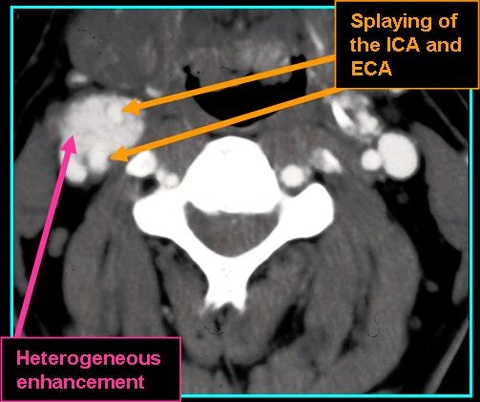 CBPara_CT_0721.jpg CBPara_CT_0721
